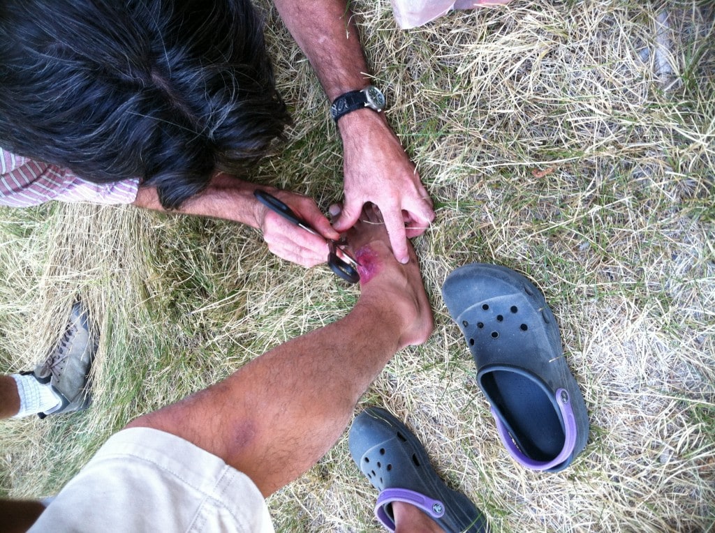 John Jackson putting the finishing touches on a make up job mimicking a sting ray stinger laceration